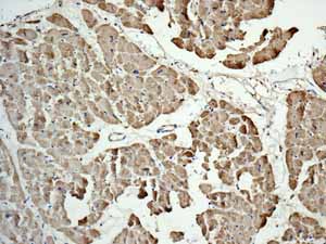 Immunohistochemistry (Formalin/PFA-fixed paraffin-embedded sections) - Anti-TNNC1 antibody [EPR9692(B)] (AB137130), expandable thumbnail