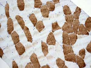 Immunohistochemistry (Formalin/PFA-fixed paraffin-embedded sections) - Anti-TNNC1 antibody [EPR9692(B)] (ab137130), expandable thumbnail