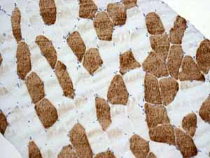 Immunohistochemistry (Formalin/PFA-fixed paraffin-embedded sections) - Anti-TNNC1 antibody [EPR9692(B)] (AB137130)