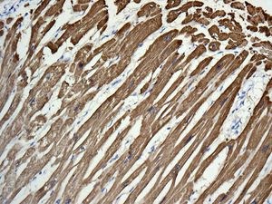 Immunohistochemistry (Formalin/PFA-fixed paraffin-embedded sections) - Anti-TNNC1 antibody [EPR9692(B)] (AB137130), expandable thumbnail