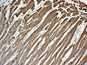 Immunohistochemistry (Formalin/PFA-fixed paraffin-embedded sections) - Anti-TNNC1 antibody [EPR9692(B)] (AB137130)