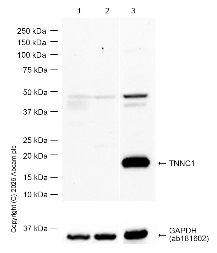 Western blot - Anti-TNNC1 antibody [EPR9692(B)] (AB137130)