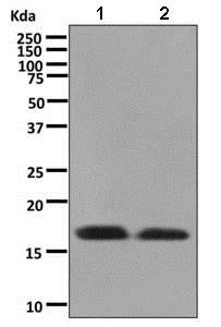 Western blot - Anti-TNNC1 antibody [EPR9692(B)] (AB137130), expandable thumbnail