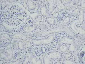 Immunohistochemistry (Formalin/PFA-fixed paraffin-embedded sections) - Anti-TNNC1 antibody [EPR9692(B)] - BSA and Azide free (AB248838)