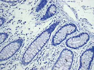 Immunohistochemistry (Formalin/PFA-fixed paraffin-embedded sections) - Anti-TNNC1 antibody [EPR9692(B)] - BSA and Azide free (AB248838)