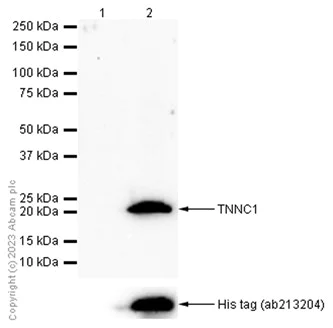 Western blot - Anti-TNNC1 antibody [EPR9692(B)] - BSA and Azide free (AB248838)