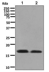 Western blot - Anti-TNNC1 antibody [EPR9692(B)] - BSA and Azide free (AB248838)