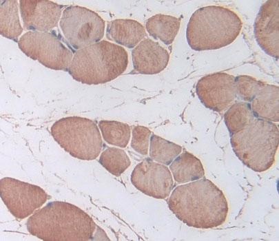 Immunohistochemistry (Formalin/PFA-fixed paraffin-embedded sections) - Anti-TNNI1 antibody (AB231720), expandable thumbnail