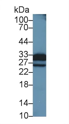 Western blot - Anti-TNNI1 antibody (AB231720)