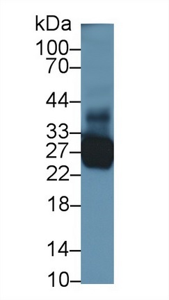Western blot - Anti-TNNI1 antibody (AB231720), expandable thumbnail