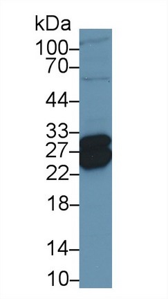 Western blot - Anti-TNNI1 antibody (AB231720), expandable thumbnail