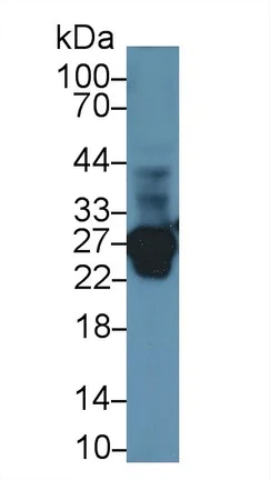 Western blot - Anti-TNNI1 antibody (AB231720)
