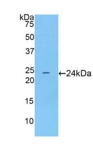 Western blot - Anti-TNNI1 antibody (ab231720), expandable thumbnail