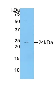 Western blot - Anti-TNNI1 antibody (AB231720)