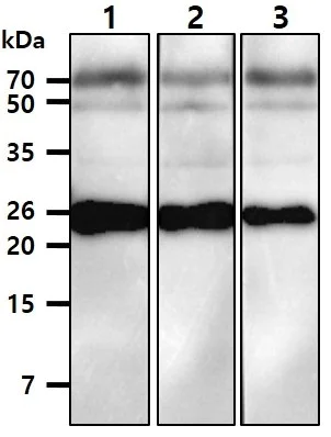 Western blot - Anti-TNNI1 antibody [AT36E7] (AB282155)