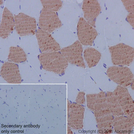 Immunohistochemistry (Formalin/PFA-fixed paraffin-embedded sections) - Anti-TNNI1 antibody [EPR17120-11] (AB203515)