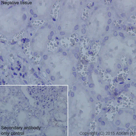 Immunohistochemistry (Formalin/PFA-fixed paraffin-embedded sections) - Anti-TNNI1 antibody [EPR17120-11] (AB203515)