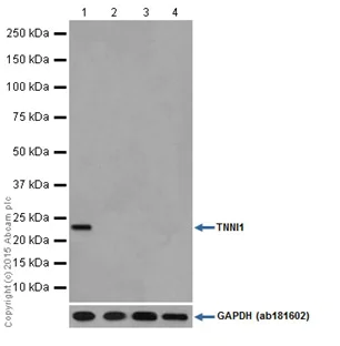 Western blot - Anti-TNNI1 antibody [EPR17120-11] (AB203515)