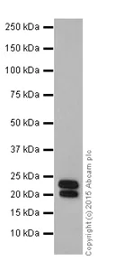 Western blot - Anti-TNNI1 antibody [EPR17120-11] - BSA and Azide free (AB251396)