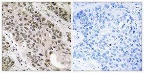 Immunohistochemistry (Formalin/PFA-fixed paraffin-embedded sections) - Anti-TNNI3K antibody (AB111140), expandable thumbnail