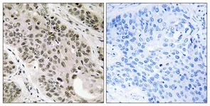 Immunohistochemistry (Formalin/PFA-fixed paraffin-embedded sections) - Anti-TNNI3K antibody (AB111140)