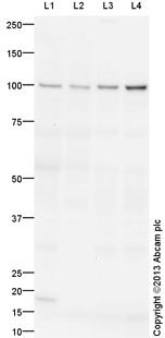 Western blot - Anti-TNNI3K antibody (AB136954)