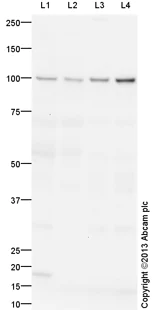 Western blot - Anti-TNNI3K antibody (AB136954)