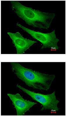 Immunocytochemistry/ Immunofluorescence - Anti-TNNI3K antibody (AB96684), expandable thumbnail