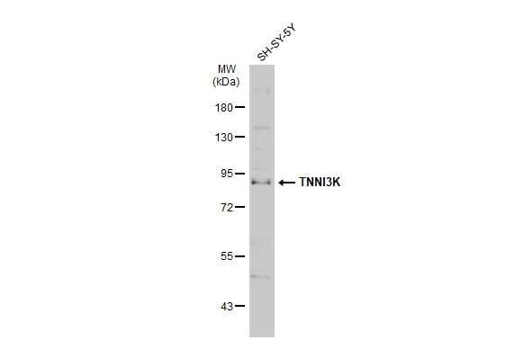 Western blot - Anti-TNNI3K antibody (AB96684), expandable thumbnail