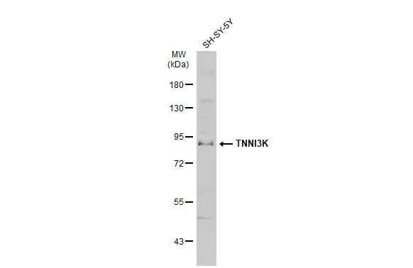 Western blot - Anti-TNNI3K antibody (AB96684)