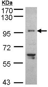 Western blot - Anti-TNNI3K antibody (AB96684), expandable thumbnail