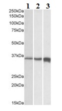 Western blot - Anti-TNNT3 antibody - C-terminal (AB175058)