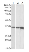 Western blot - Anti-TNNT3 antibody - C-terminal (AB175058)