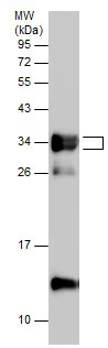 Western blot - Anti-TNNT3 antibody - C-terminal (AB229456)