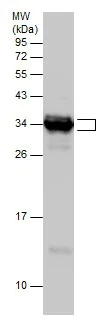 Western blot - Anti-TNNT3 antibody - C-terminal (AB229456)