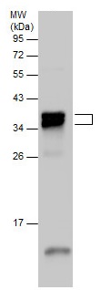 Western blot - Anti-TNNT3 antibody - C-terminal (AB229456)