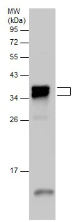Western blot - Anti-TNNT3 antibody - C-terminal (AB229456)