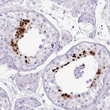 Immunohistochemistry (Formalin/PFA-fixed paraffin-embedded sections) - Anti-TNP1 antibody (AB224567)