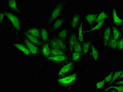 Immunocytochemistry/ Immunofluorescence - Anti-TNP1 antibody (AB234754)
