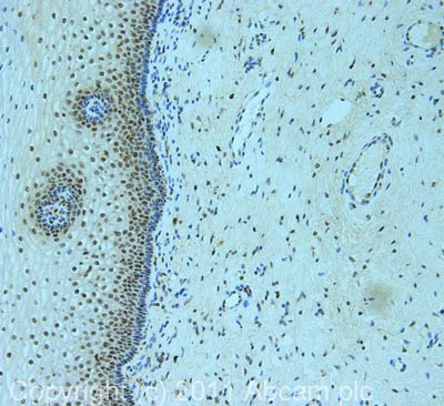 Immunohistochemistry (Formalin/PFA-fixed paraffin-embedded sections) - Anti-TNPO3 antibody [3152C2a] (AB54353)