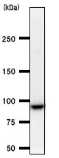 Western blot - Anti-TNPO3 antibody [3152C2a] (AB54353)