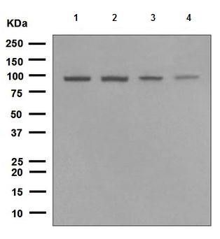 Western blot - Anti-TNPO3 antibody [EPR5264] (AB109386), expandable thumbnail