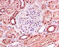 Immunohistochemistry (Formalin/PFA-fixed paraffin-embedded sections) - Anti-TNPO3 antibody [EPR5264] - BSA and Azide free (AB247842)