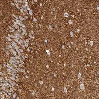 Immunohistochemistry (Formalin/PFA-fixed paraffin-embedded sections) - Anti-TNR antibody (AB121916)