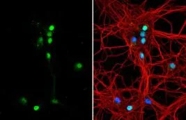 Immunocytochemistry/ Immunofluorescence - Anti-TNR antibody (AB155034)