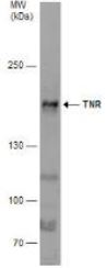 Western blot - Anti-TNR antibody (AB155034), expandable thumbnail