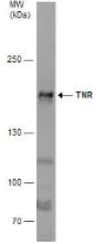 Western blot - Anti-TNR antibody (AB155034)