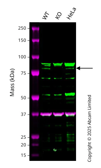 Western blot - Anti-TNS4/CTEN antibody [EPR13792] - BSA and Azide free (AB251118)