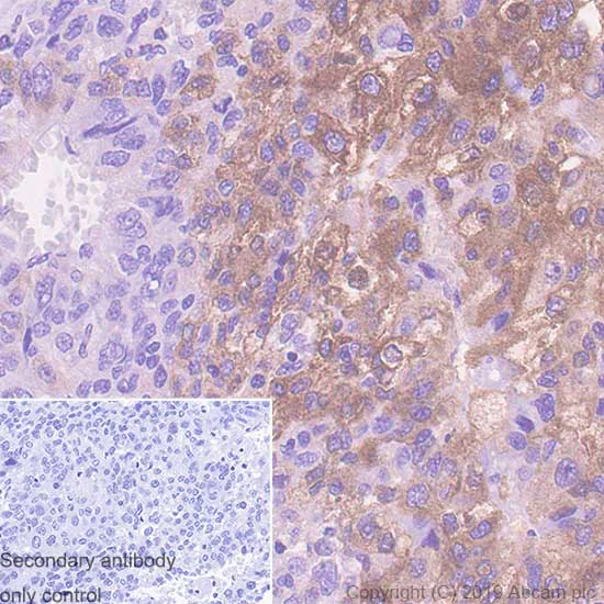 Immunohistochemistry (Formalin/PFA-fixed paraffin-embedded sections) - Anti-TNS4/CTEN antibody [SP83] (AB99887)