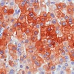 Immunohistochemistry (Formalin/PFA-fixed paraffin-embedded sections) - Anti-TNS4/CTEN antibody [SP83] - BSA and Azide free (AB238802)
